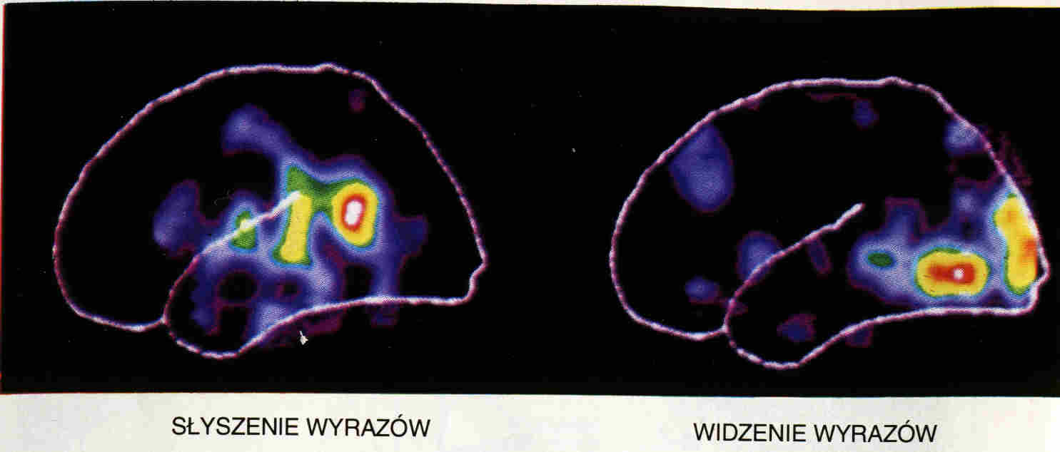 fMRI wyrazy