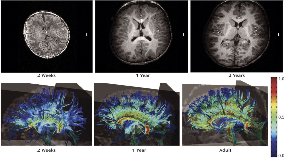 2w-2y brain