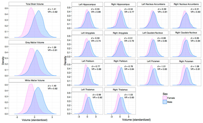 Female-male-brains-chart.